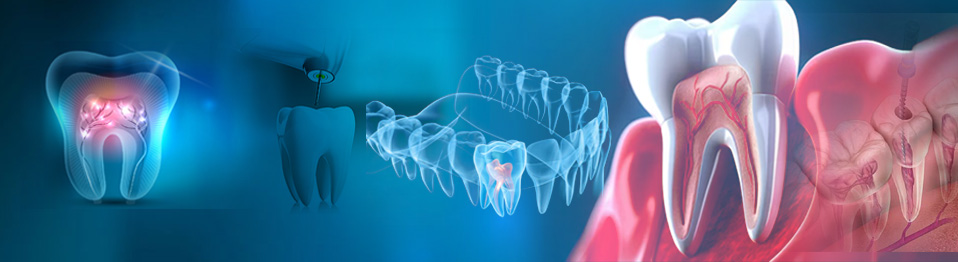 Endodontics top 0
