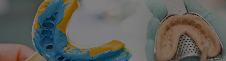 dental impression materials top 0