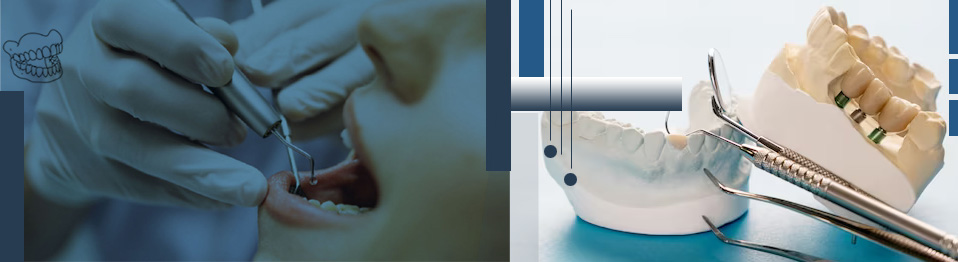 Prosthodontic top 0