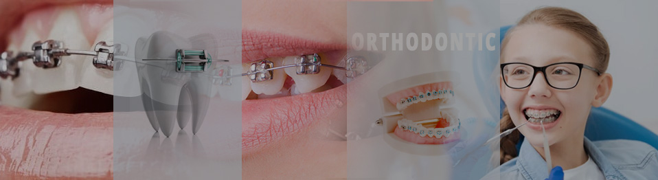 orthodontics top 0