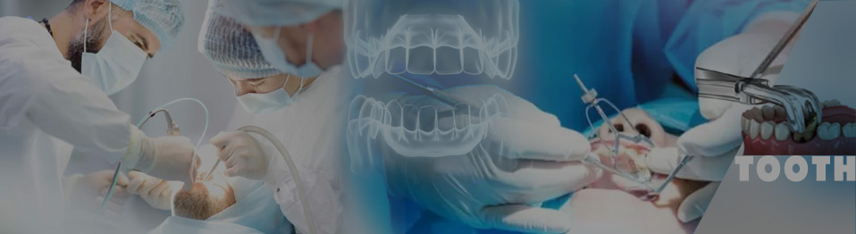 oral surgical top 0