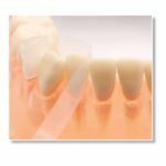 Transparent-Strips-Cellophane-Strips-100-pcs